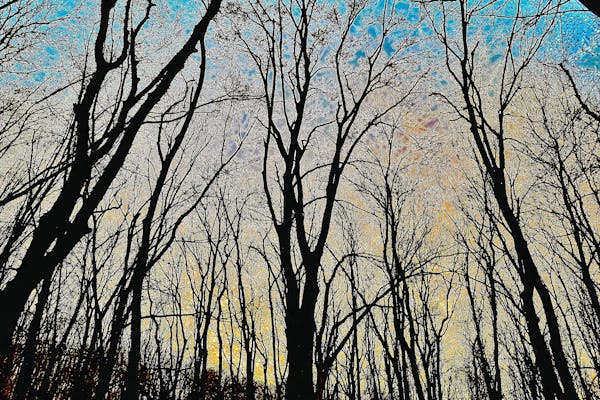 Beard Transplant Guide